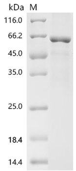 Recombinant Human Elongator complex protein 3 (ELP3)