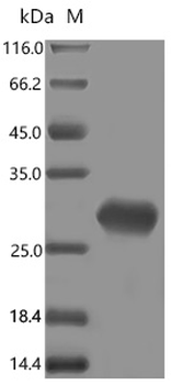 Recombinant Human Complement factor H-related protein 5 (CFHR5), partial