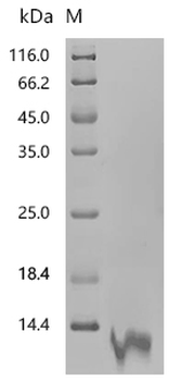 Recombinant Human Interleukin-8 (CXCL8), partial (Active)