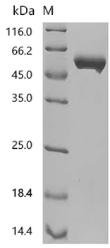 Recombinant Human Tyrosine-protein kinase transmembrane receptor ROR2 (ROR2), partial (Active)