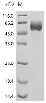 Recombinant Human Interleukin-1 receptor-like 1 (IL1RL1), partial (Active)