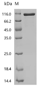 Recombinant Human Neural cell adhesion molecule 1 (NCAM1), partial (Active)