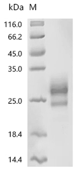 Recombinant Human E3 ubiquitin-protein ligase RNF43 (RNF43), partial