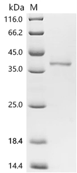 Recombinant Human Solute carrier family 45 member 3 (SLC45A3), partial