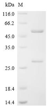 Recombinant Human Importin subunit beta-1 (KPNB1)