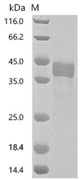 Recombinant Human Tumor necrosis factor receptor superfamily member 17 (TNFRSF17), partial (Active)