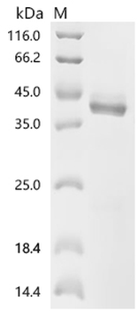 Recombinant Human IL23A&IL12B Heterodimer Protein (Active)