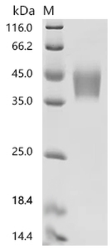 Recombinant Human Cytokine receptor-like factor 2 (CRLF2), partial, Biotinylated (Active)