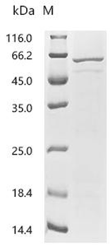 Recombinant Human Cerebellar degeneration-related protein 2(CDR2)