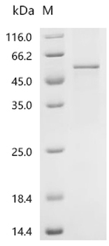 Recombinant Human Protein Wnt-10a (WNT10A)