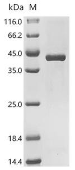 Recombinant Mouse Thymidylate synthase (Tyms)