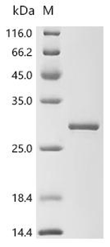 Recombinant Human E3 ubiquitin-protein ligase RNF130 (RNF130), partial