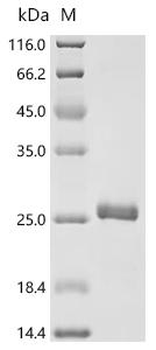 Recombinant Human immunodeficiency virus type 1 group M subtype B Protein Rev (rev)