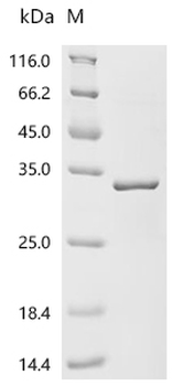 Recombinant Human Akirin-2 (AKIRIN2)