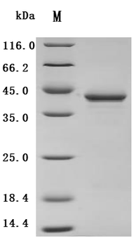 Recombinant Macaca fascicularis Parathyroid hormone (PTH) (Active)