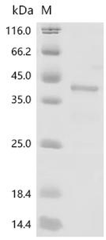 Recombinant Human Paired box protein Pax-8 (PAX8), partial