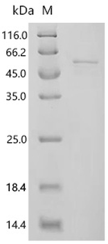 Recombinant Mouse Acyl-protein thioesterase 1 (Lypla1)