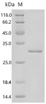 Recombinant Human Lactase-phlorizin hydrolase (LCT), partial