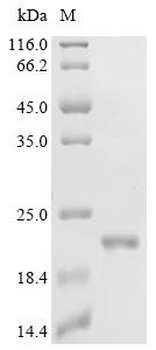 Recombinant Human Ragulator complex protein LAMTOR3 (LAMTOR3)
