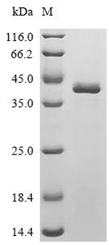 Recombinant Human Hereditary hemochromatosis protein (HFE), partial