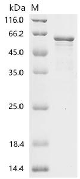 Recombinant Human Hepatocyte nuclear factor 3-alpha (FOXA1)