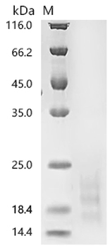 Recombinant Human Myosin regulatory light chain 12A (MYL12A)