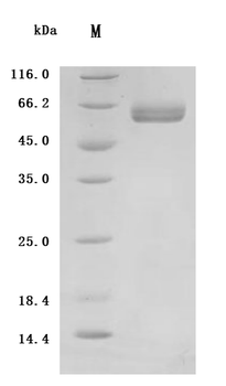 Recombinant Human Tumor necrosis factor receptor superfamily member 3 (LTBR), partial (Active)