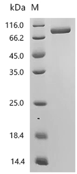 Recombinant Human Interleukin-1 receptor type 2 (IL1R2), partial (Active)