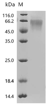 Recombinant Human Eukaryotic translation initiation factor 4E-binding protein 1 (EIF4EBP1)