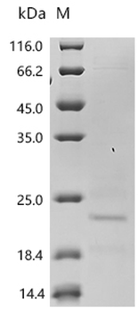 Recombinant Mouse Inactive tyrosine-protein kinase transmembrane receptor ROR1 (Ror1), partial (Active)