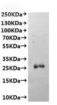 Recombinant Hepatitis B virus genotype C subtype adr Large envelope protein (S)-VLPs