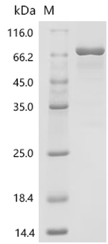 Recombinant Human Protein-arginine deiminase type-3 (PADI3)