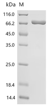 Recombinant Human Protein-arginine deiminase type-1 (PADI1)