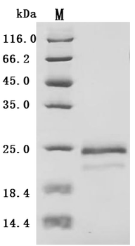 Recombinant Human Vascular endothelial growth factor A, long form (VEGFA) (Active)
