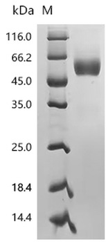 Recombinant Human Transmembrane and immunoglobulin domain-containing protein 2 (TMIGD2), partial