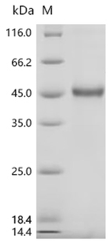 Recombinant Human Teratocarcinoma-derived growth factor 1 (TDGF1)