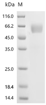 Recombinant Mouse Interleukin-1 receptor accessory protein (Il1rap), partial (Active)