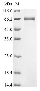 Recombinant Human Transcriptional enhancer factor TEF-1 (TEAD1)