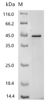 Recombinant Human Reticulocalbin-2 (RCN2)