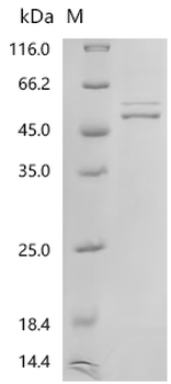 Recombinant Human Nucleosome assembly protein 1-like 1 (NAP1L1)