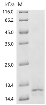 Recombinant Human Bromodomain-containing protein 2 (BRD2), partial
