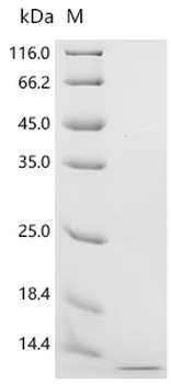 Recombinant Human Kidney-associated antigen 1(KAAG1)