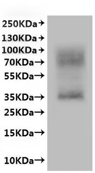 Recombinant Human P2Y purinoceptor 8 (P2RY8)-VLPs