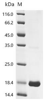 Recombinant Human Serine protease inhibitor Kazal-type 9 (SPINK9)