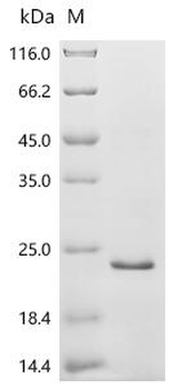Recombinant Human Solute carrier family 22 member 4 (SLC22A4), partial