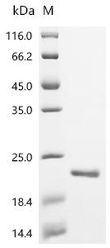 Recombinant Pseudomonas aeruginosa Large ribosomal subunit protein bL12 (rplL)