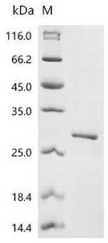 Recombinant Human Prostaglandin-H2 D-isomerase (PTGDS) (145-156:MATLYSRTQTPR→Missing)