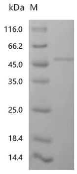Recombinant Human Paraneoplastic antigen Ma1 (PNMA1)