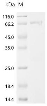 Recombinant Mouse Pituitary homeobox 3 (Pitx3)