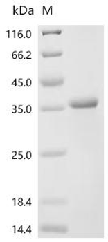 Recombinant Human Serine/threonine-protein kinase Nek9 (NEK9), partial